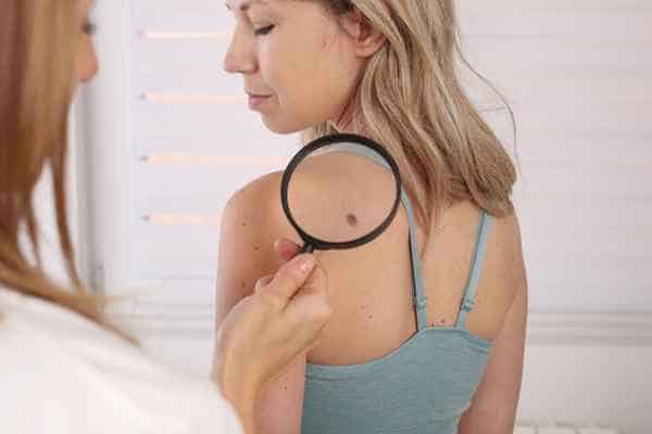 What Are Traditional Skin Lesion Removal Methods Pinner?