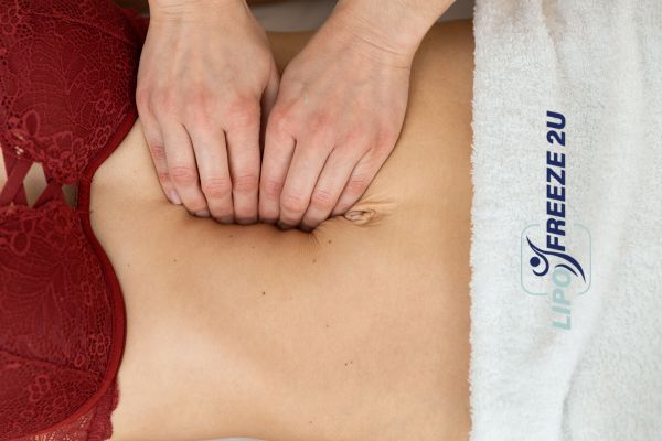 diastasis recti treatment Pinner