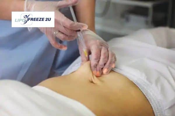 Fat Dissolving Injections Pinner & Weight loss medication