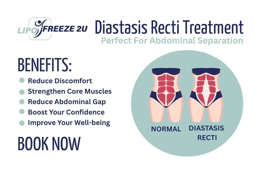 Benefits of body toning treatment Pinner for Diastasis recti