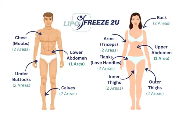Areas you can have fat freezing treatment Pinner