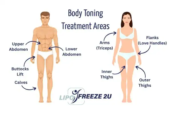 Graphic showing where you can have Body toning Treatment Pinner on your body