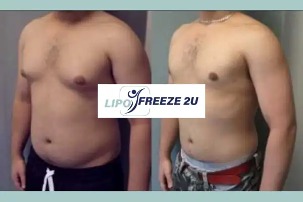 How Long Does It Take to See Results Pinner?